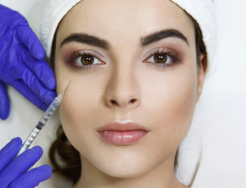 Botox for Beginners: Everything You Need to Know Before Your First Treatment